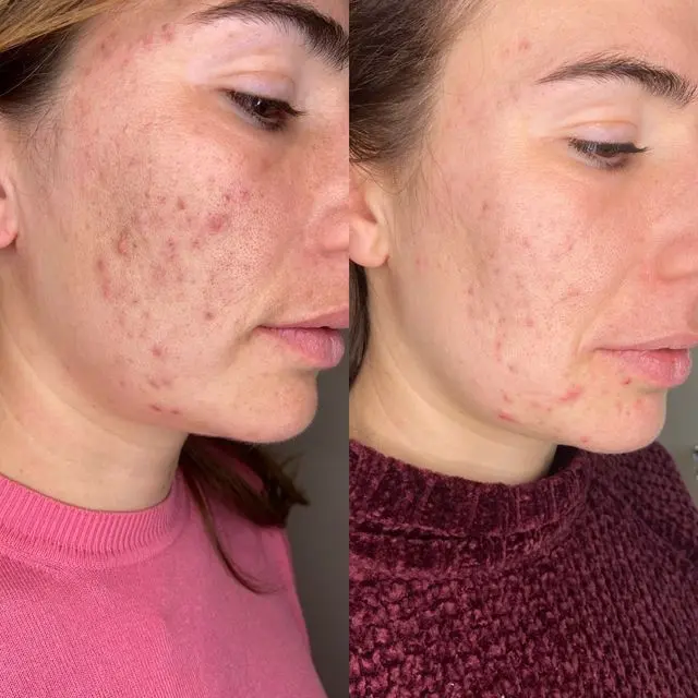 Natural Results
