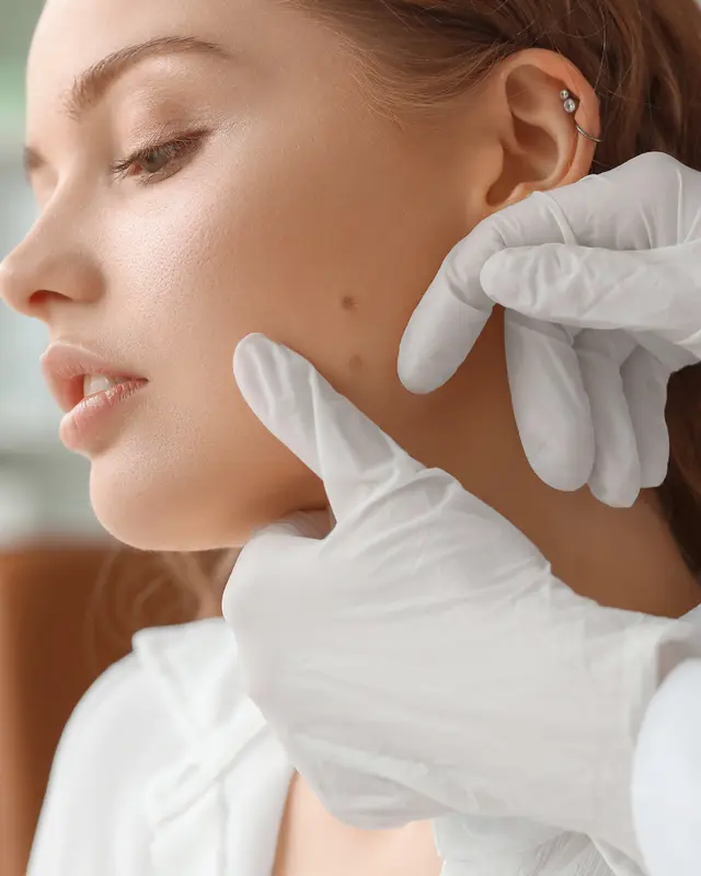 Mole screening facial skin assessment