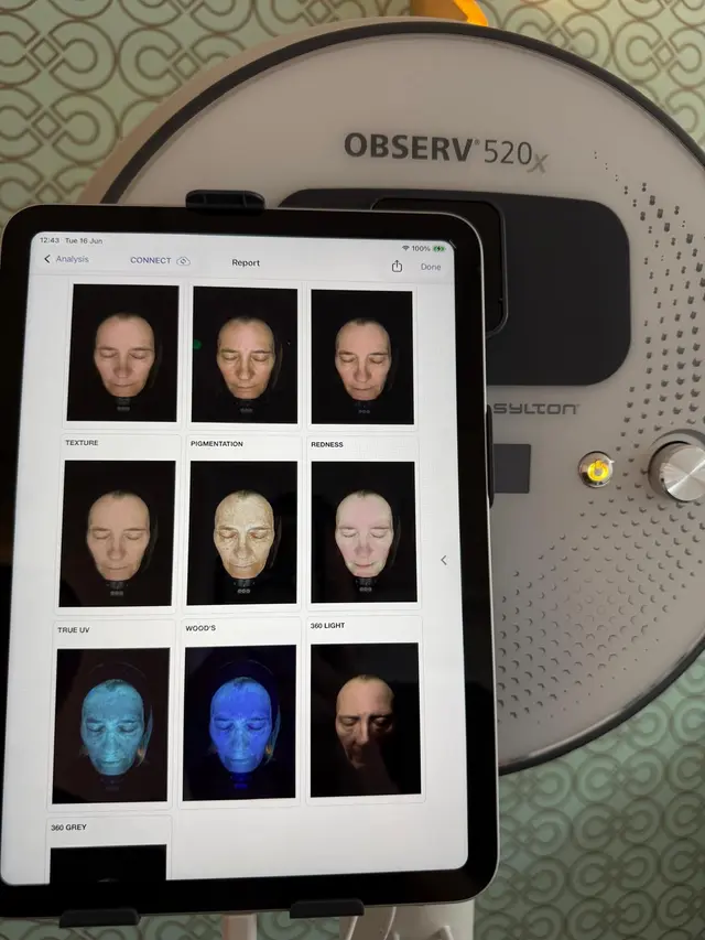 Observe 520x skin analysis system during a skin consultation